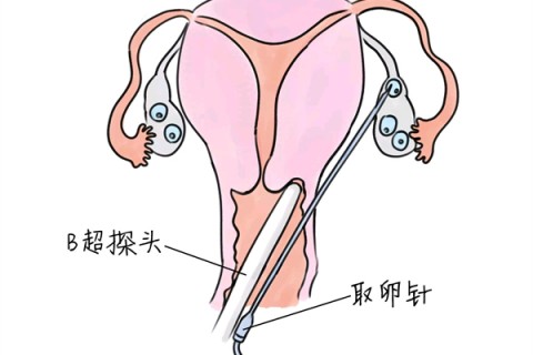 http://weifang.vdtfzz.com/post/205.html|潍坊供卵助孕